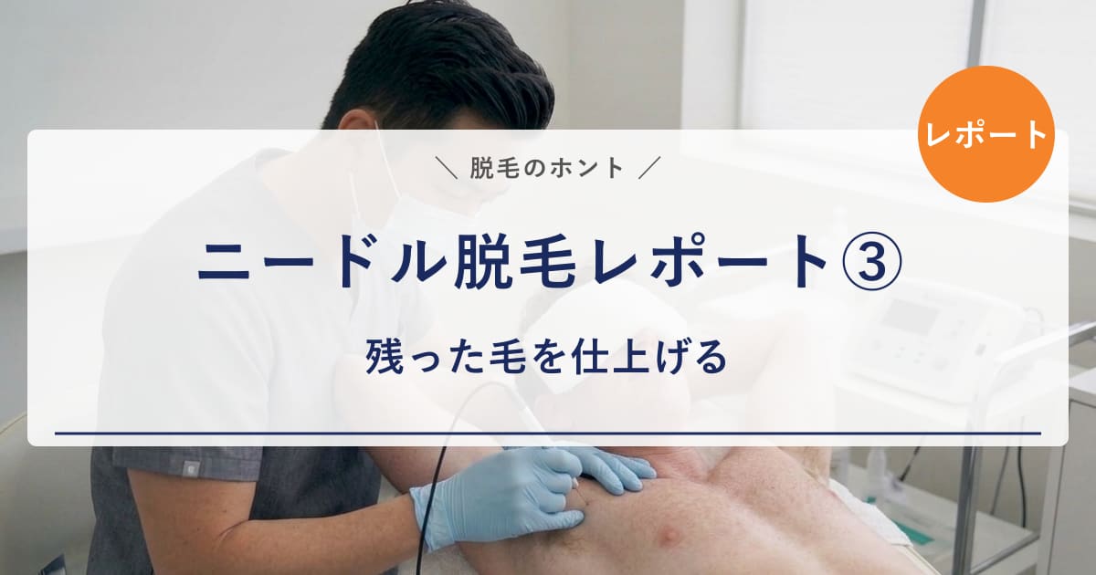 【ニードル脱毛レポート③】残った毛をニードルで仕上げる｜1時間でヒゲ・VIO・乳輪、部位ごとの痛みの違いを正直レポート